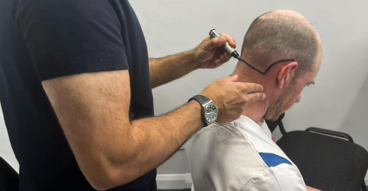 FUE hair transplant procedure