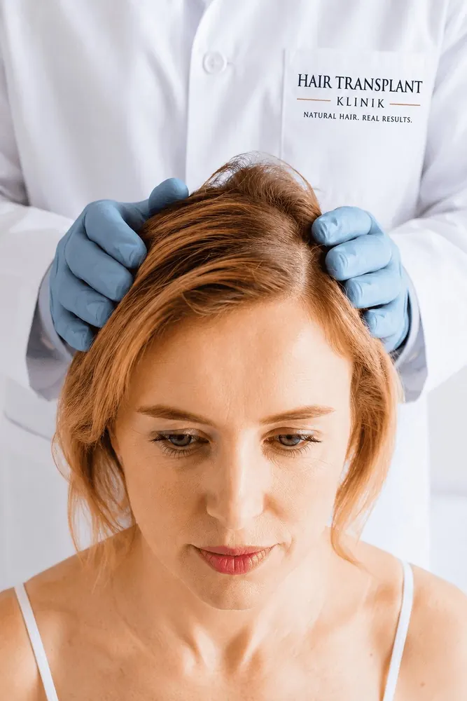 Hair Loss Treatment for Women