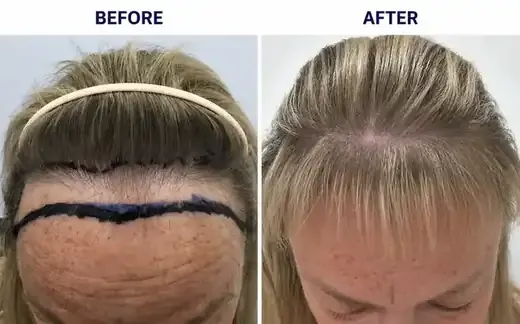 Density added, hair left long